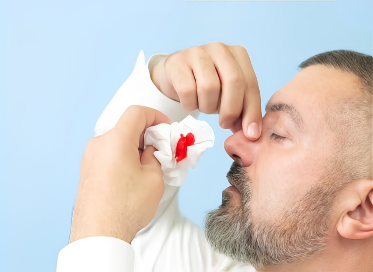 Sangue no nariz ao assoar: O que pode ser e o que fazer?