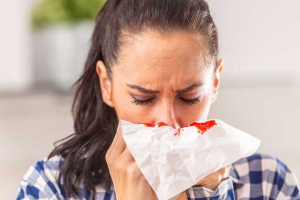 Hemorragia nasal – como devo agir